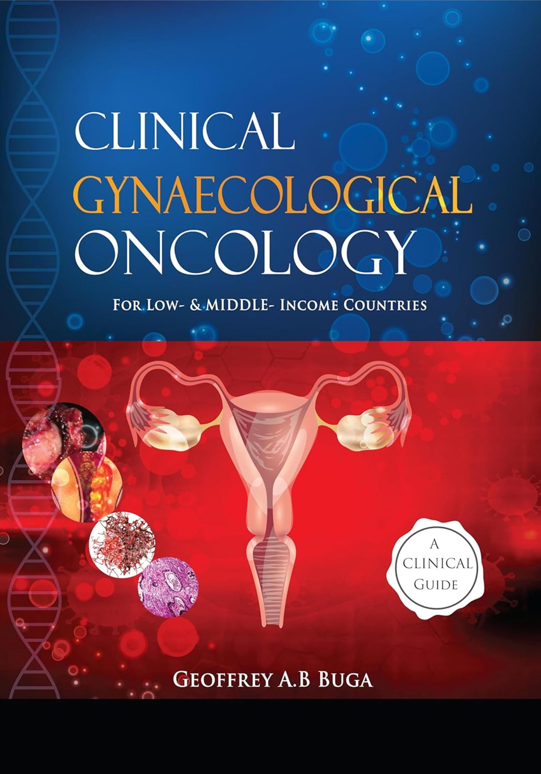 Clinical Gynaecological Oncology for Low- and Middle-Income Countries